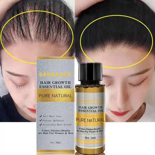 Saksraar hair oil for growing hair showing before and after results with fuller hair and product bottle