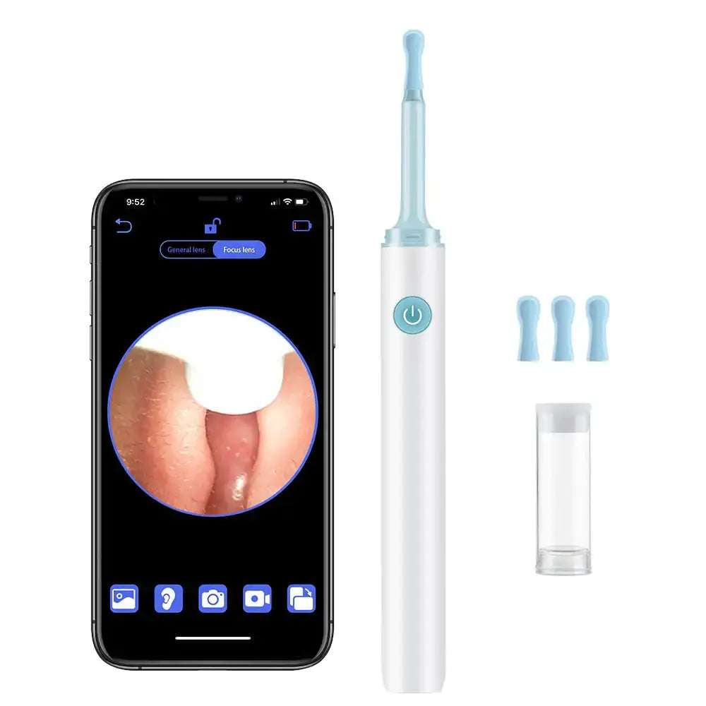 Allebuy ear wax in ear removal tool with camera and smartphone display for clear ear inspection