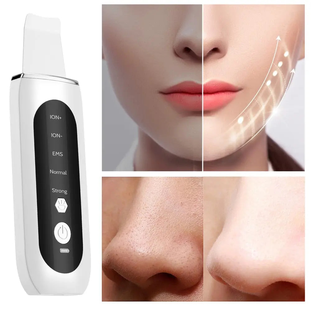 Allebuy exfoliating face scrubber device with close-up images showing improved facial skin texture and pore cleansing