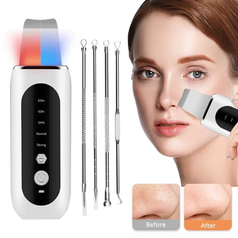 Allebuy exfoliating face scrubber with metal extractor tools and demonstration on woman with before and after skin results