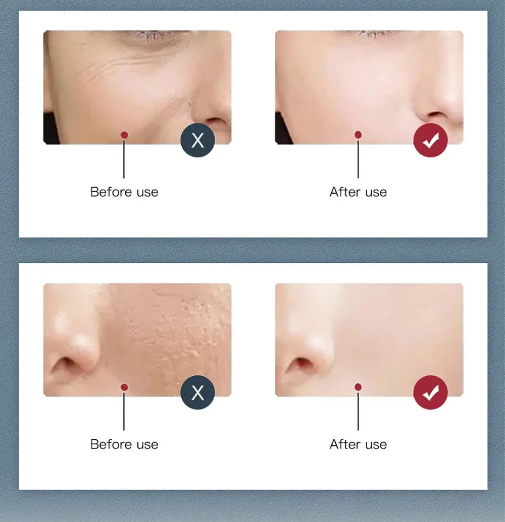 Before and after skin improvement results using red light therapy lights showing reduced wrinkles and smoother skin texture
