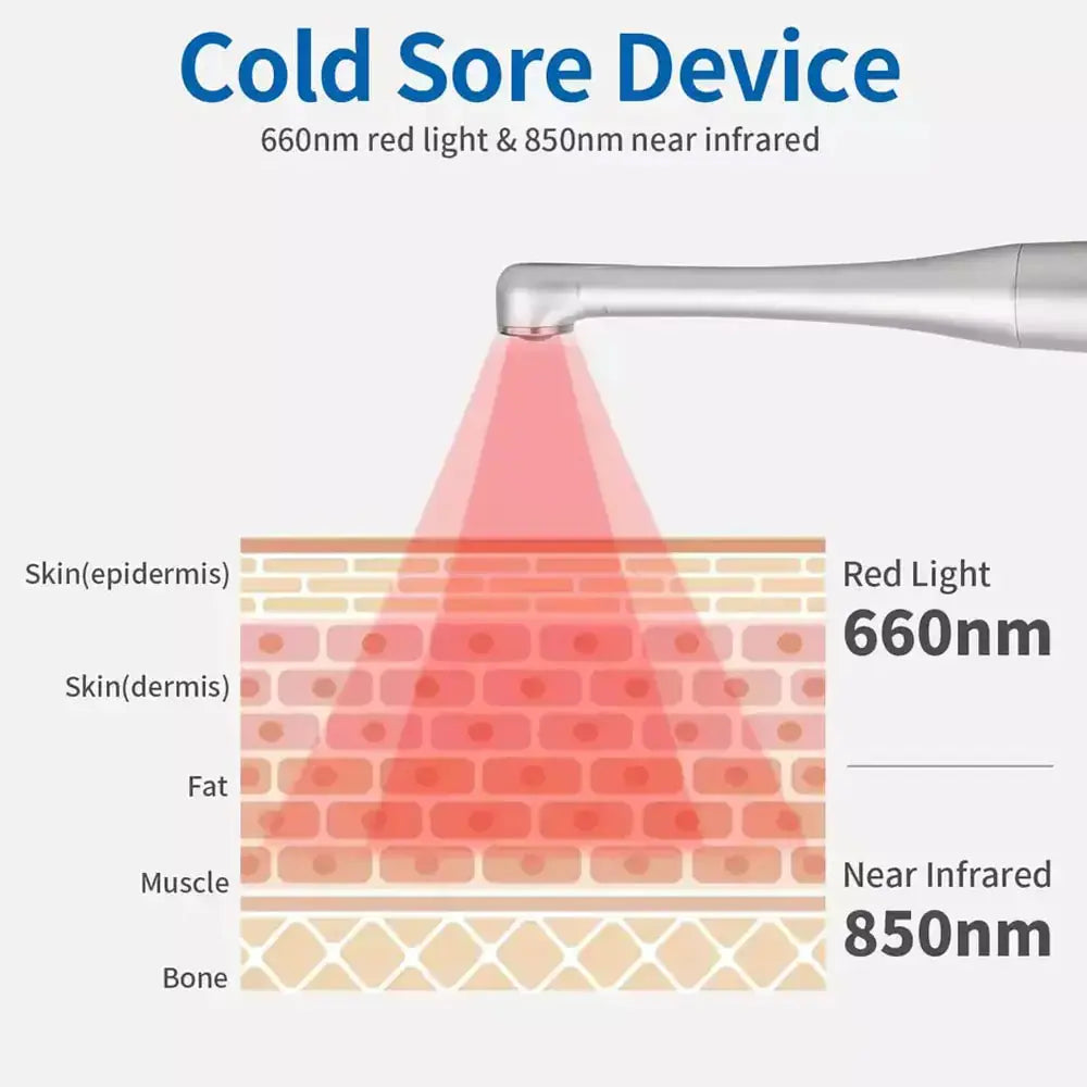 Cold sore device using 660nm red light and 850nm near infrared for red-light therapy on skin layers